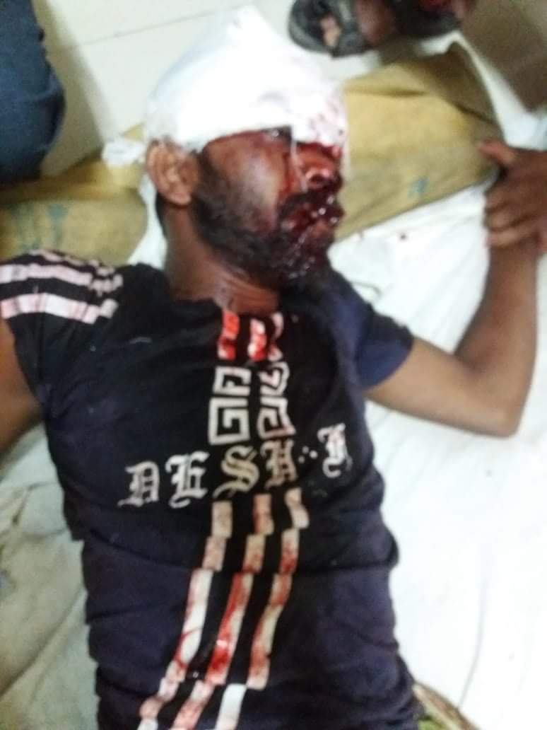 হবিগঞ্জ নবীগঞ্জ সড়কে দূর্ঘটনায় মোটসাইকেল চালক নিহত