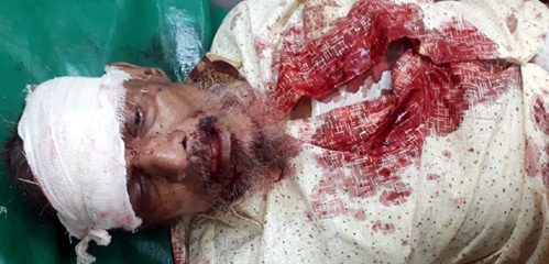 ঢাকা-সিলেট মহাসড়কের নোয়াপাড়ায় সড়ক দূর্ঘটনায় আহত ৬