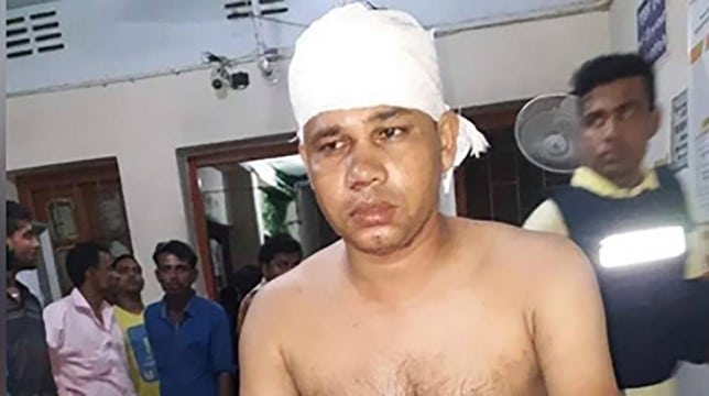 আসামির কোপে গুরুতর জখম ওসি-এসআই