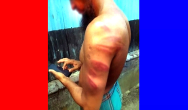 মেয়ের সামনে শিক্ষক বাবাকে রড দিয়ে পেটালেন চেয়ারম্যান !