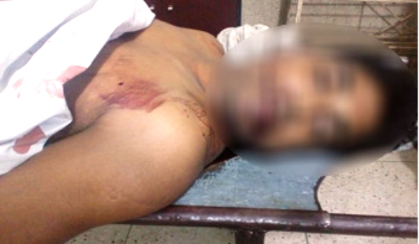 লিফটে চাপা পড়ে মৃত্যু