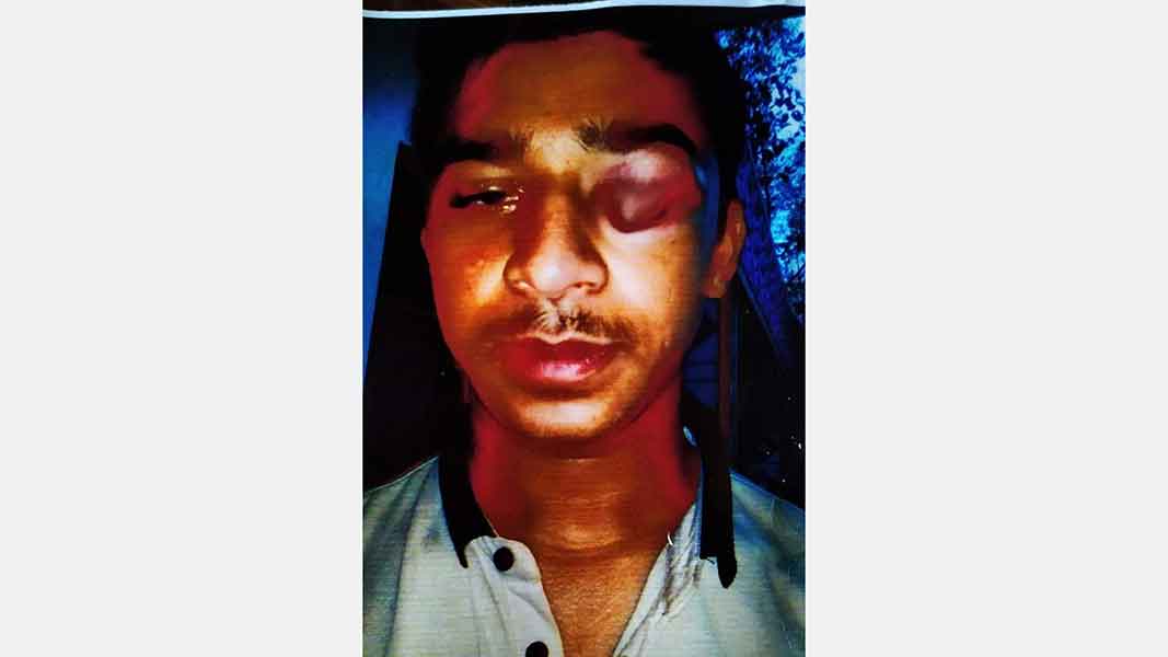 মাধবপুরে স্কুল শিক্ষকের পরিবারকে মারপিট করে জমি দখলের চেষ্টা