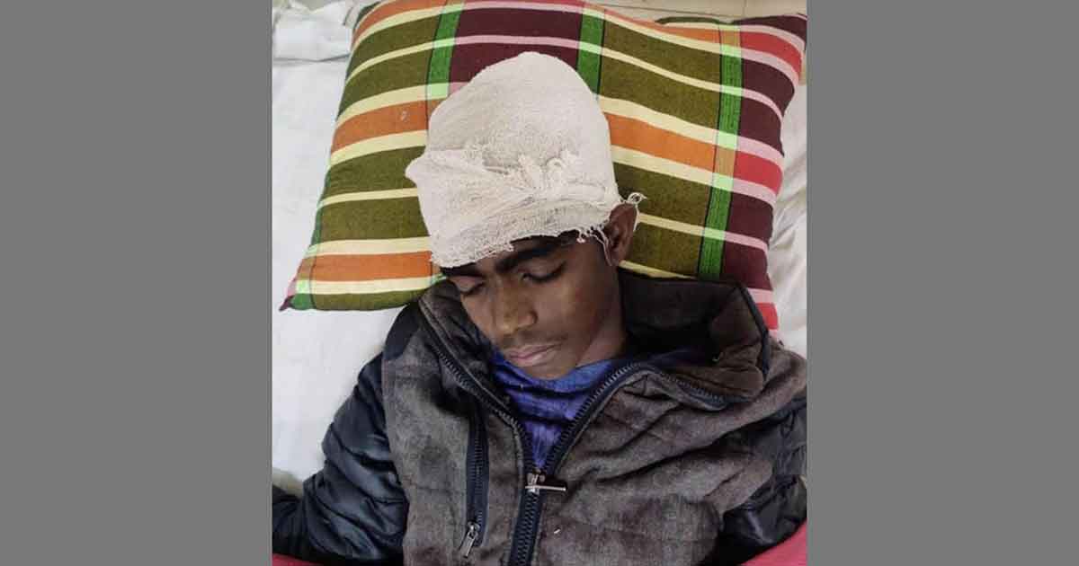 বানিয়াচংয়ের কাঠখালে কৃষককে পিটিয়ে আহত