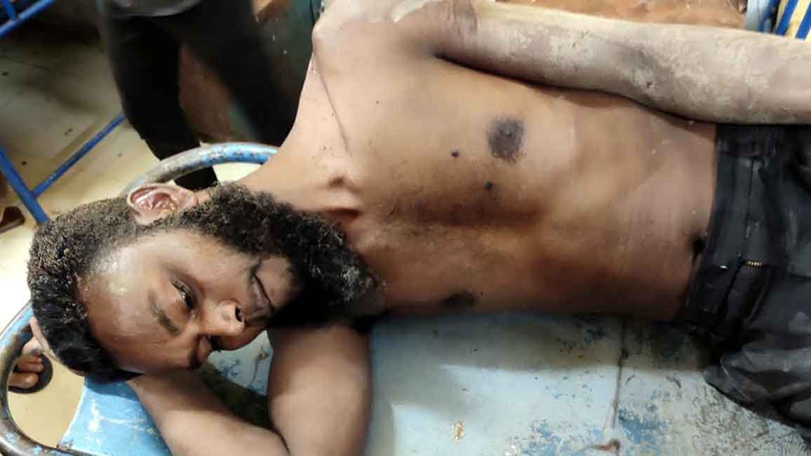 শহরে-বিদ্যুতস্পৃষ্ট-হয়ে-আহত-হয়েছে-এক-শ্রমিক শহরে-বিদ্যুতস্পৃষ্ট-হয়ে-আহত-হয়েছে-এক-শ্রমিক