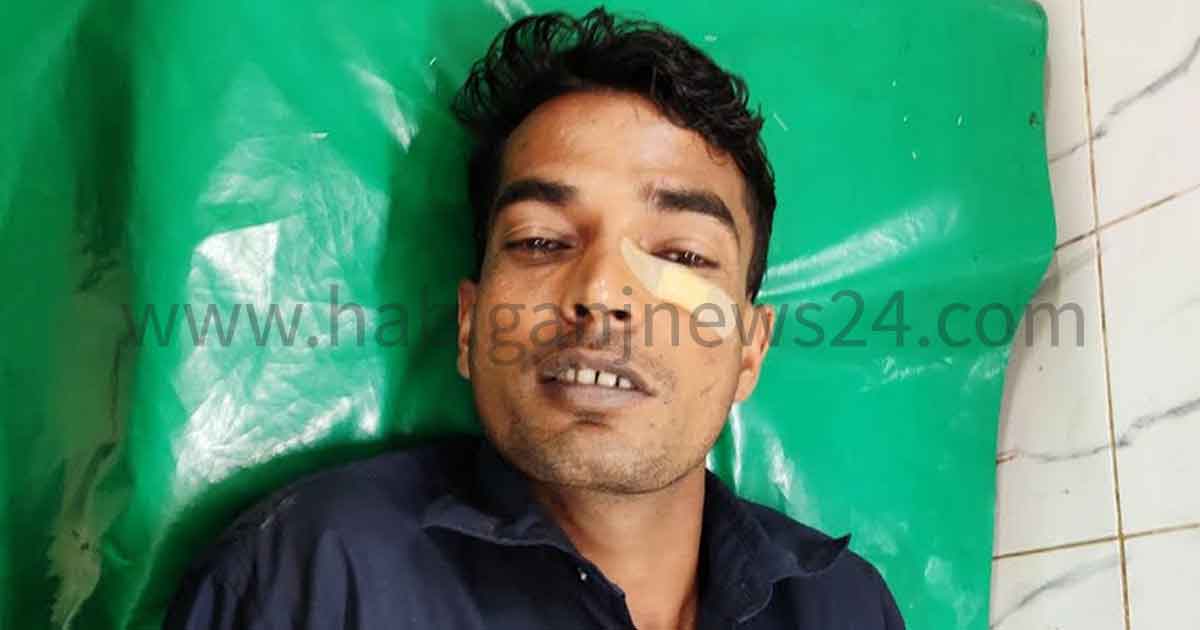 বানিয়াচংয়ে তুচ্ছ ঘটনাকে কেন্দ্র করে এক ব্যক্তিকে কুপিয়ে ক্ষতবিক্ষত