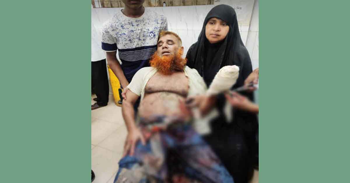 হবিগঞ্জ সদরে ৪ সহোদরের হামলায় অপর ভাই আহত