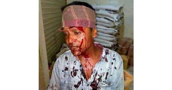 চুনারুঘাটে রডের আঘাতে সাংবাদিক আহত