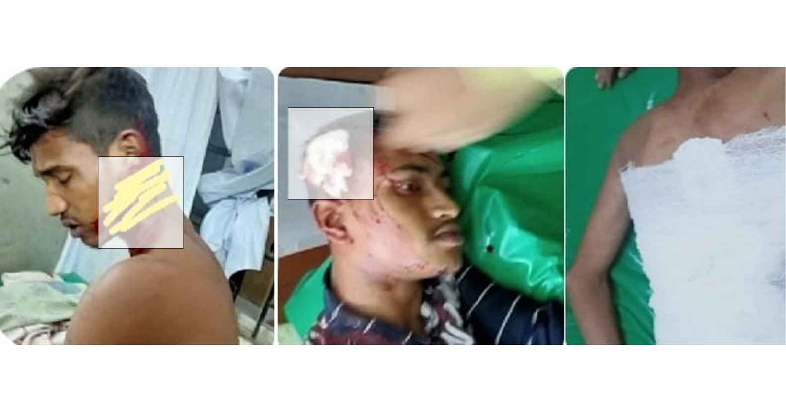 চুনারুঘাটে কিশোর গ্যাংয়ের হামলায় আহত ৩