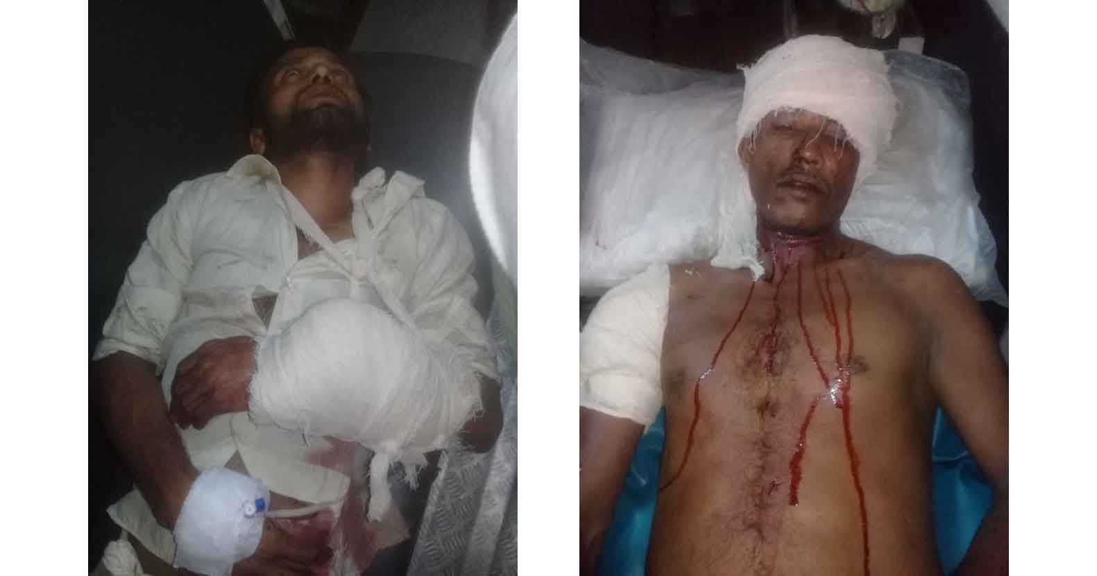 Habiganj-News-বাহুবলে-মেয়ের-জামাইর-হামলায়-শশুরসহ-আহত-৩ বাহুবলে মেয়ের জামাইর হামলায় শশুরসহ আহত ৩