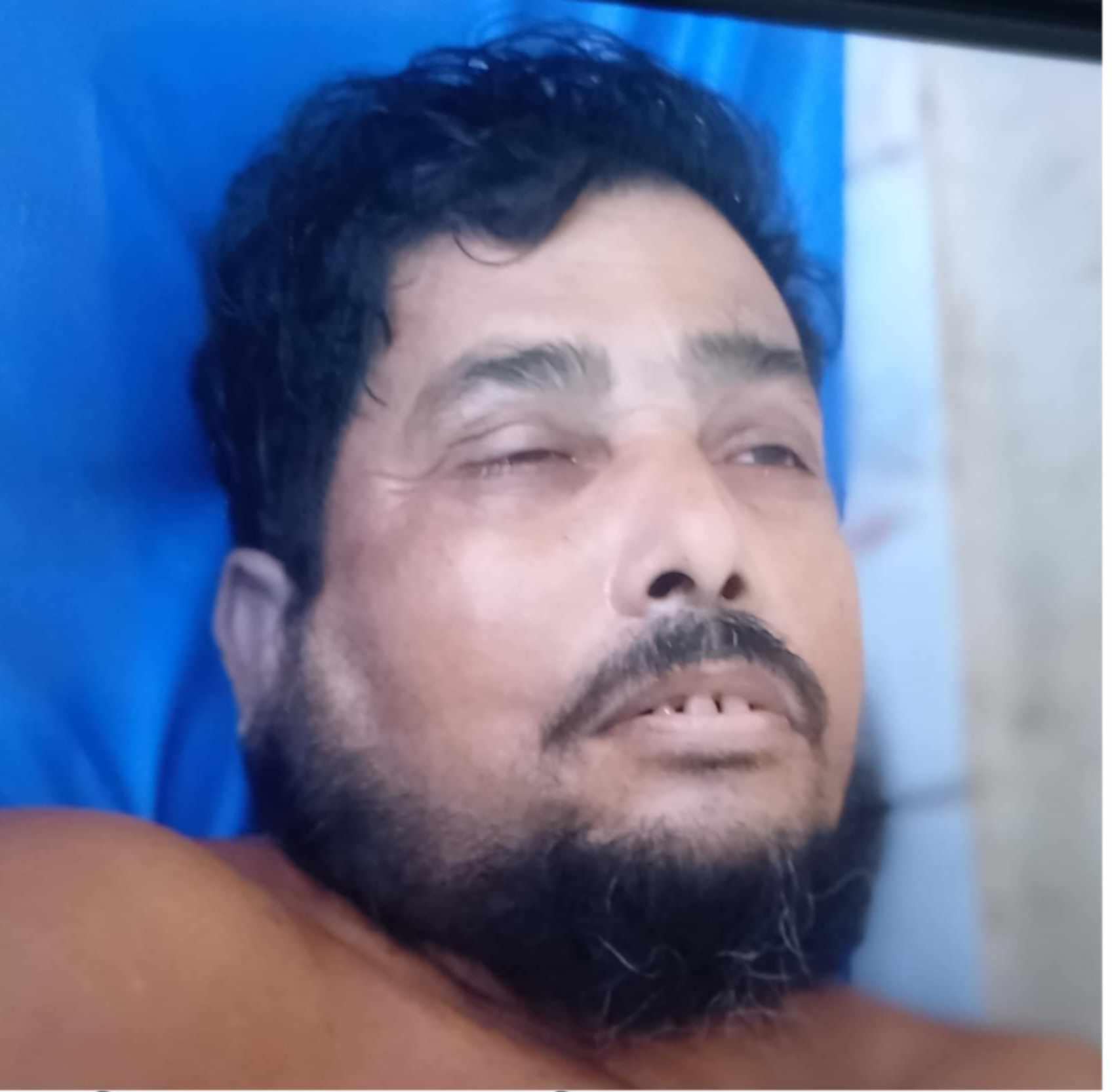 চুনারুঘাটে প্রবাসীর বাড়িতে ডাকাতদের হামলায় নিহত ১