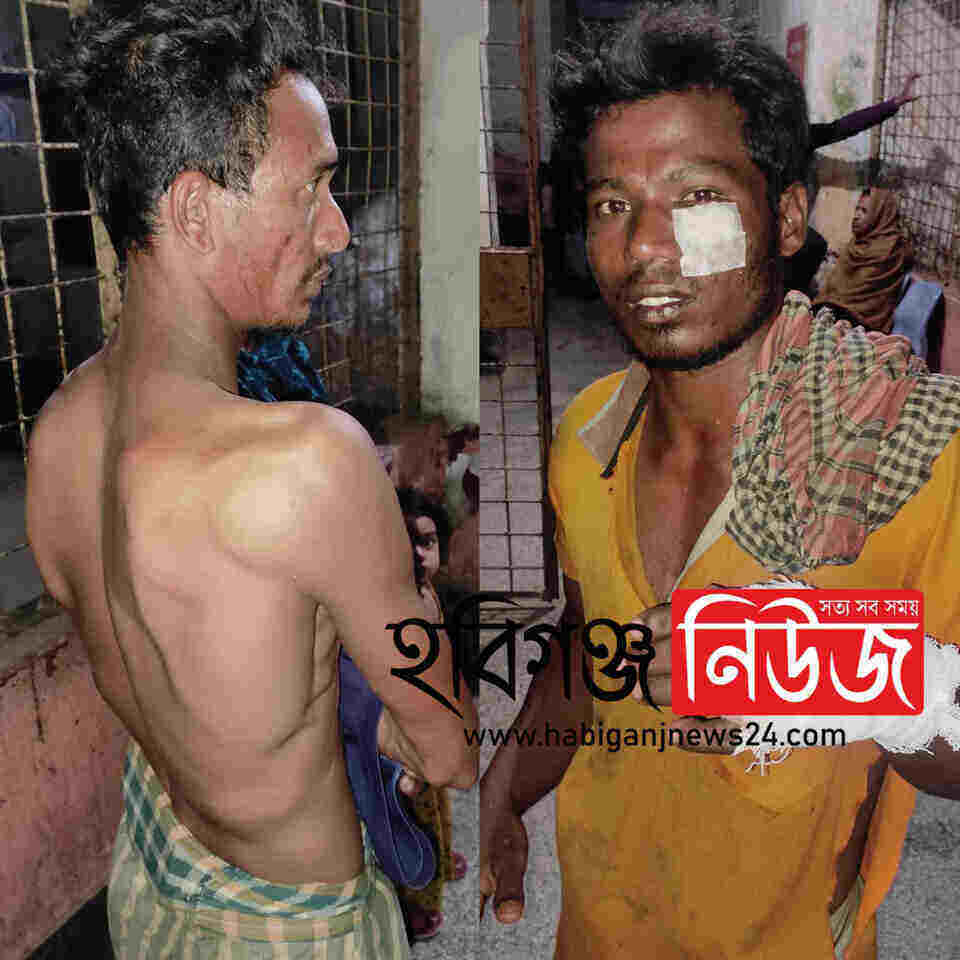 নবীগঞ্জে হাঁসকে কেন্দ্র করে ২ জন আহত – Habiganj News